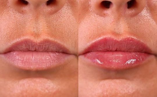 Patient Results - Skinrejuvenate