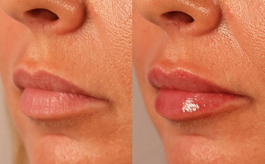 Patient Results - Skinrejuvenate